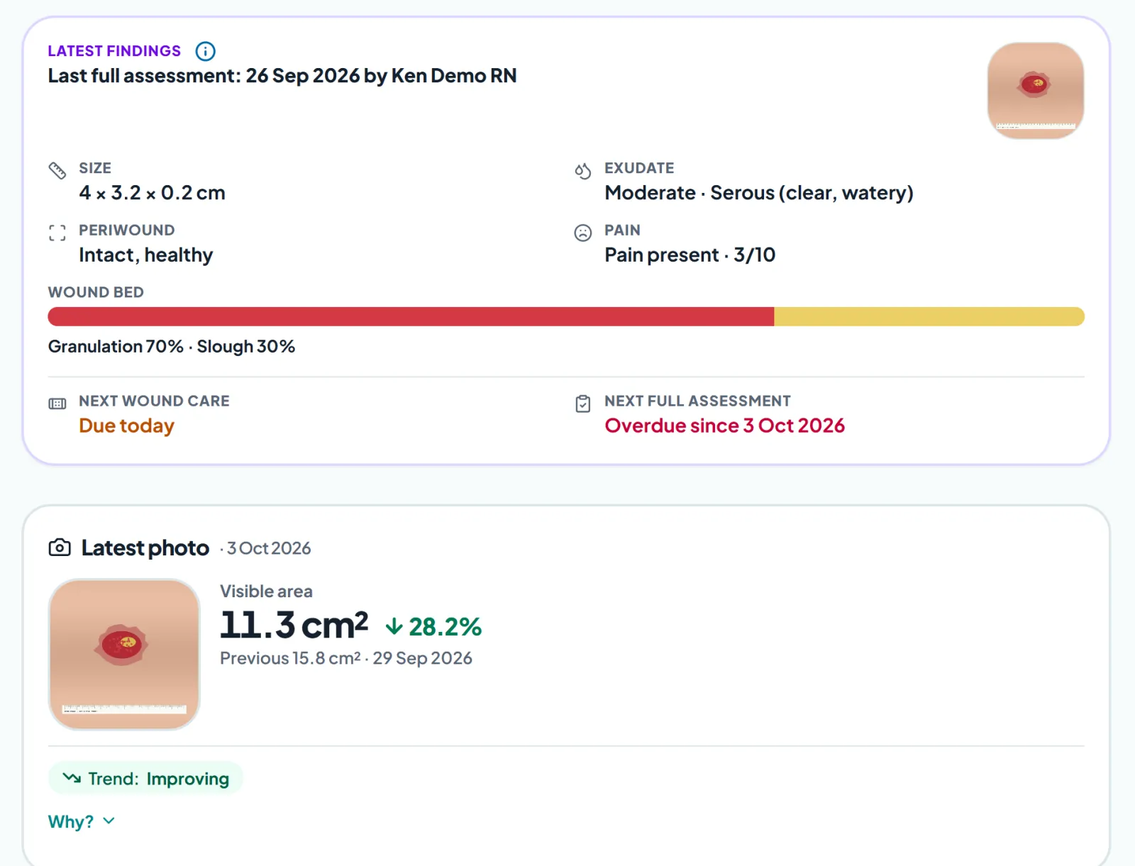 A wound's page in WoundLane: the latest findings (size, exudate, periwound, pain, wound bed), the latest photo with its visible area and an improving trend, and when care and the next full assessment are due.